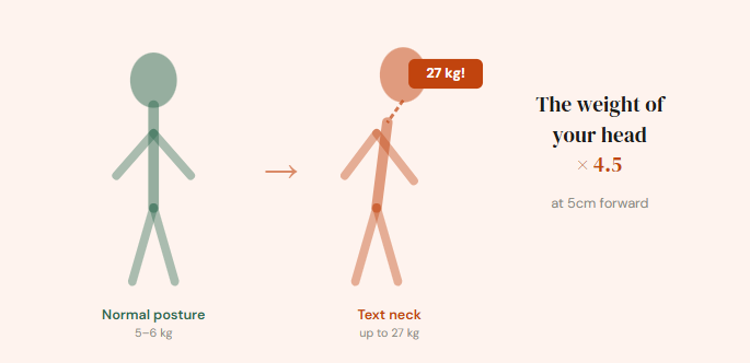Text neck: the silent condition affecting everyone who works on a screen
